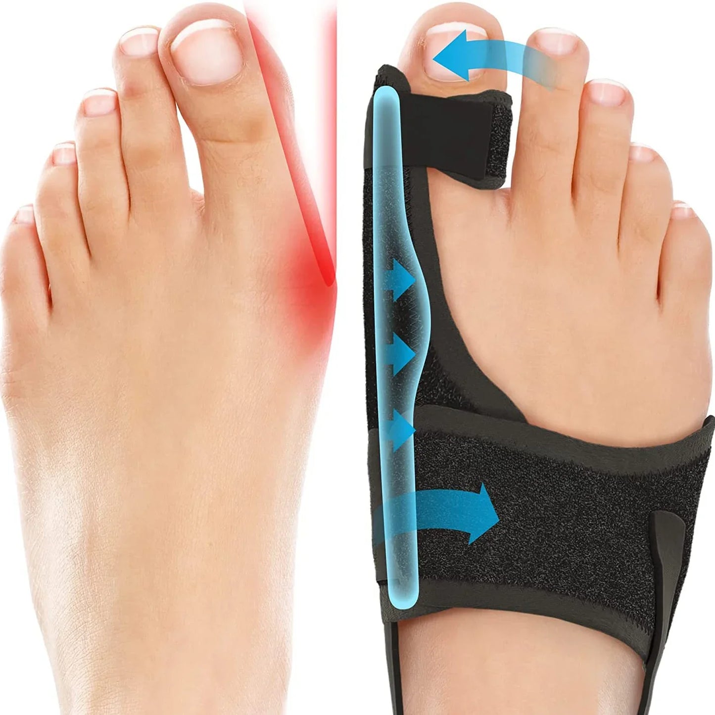 Orthopedic Bunion Splint Corrector for Hallux Valgus Pain Relief