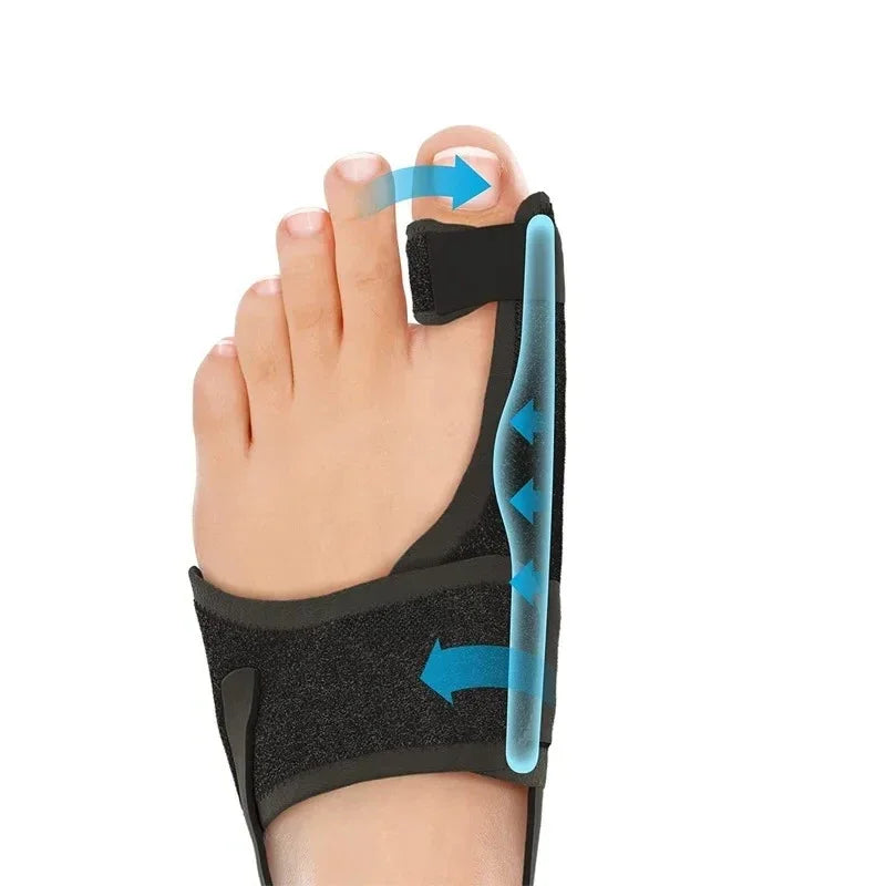 Orthopedic Bunion Splint Corrector for Hallux Valgus Pain Relief