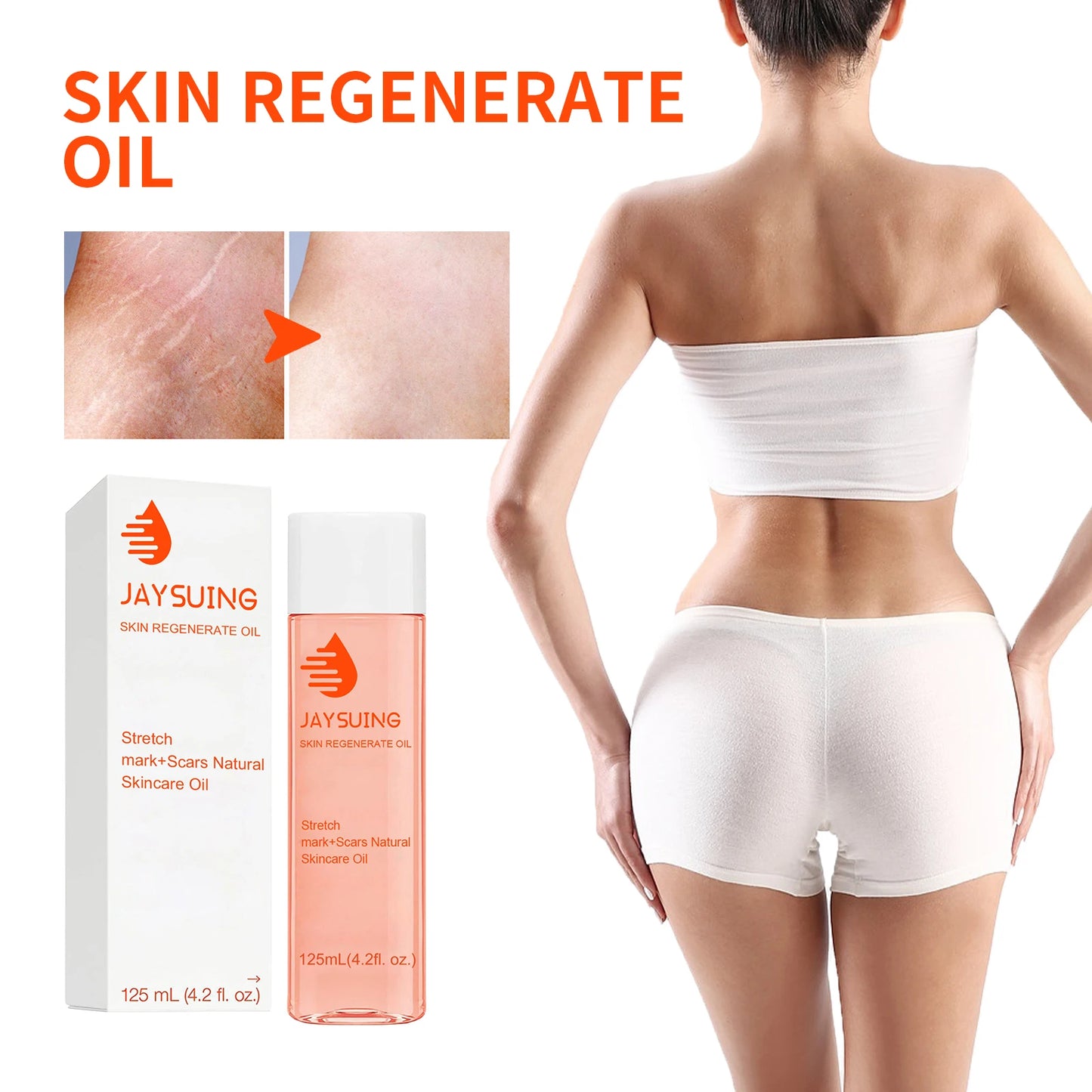 Jaysuing Scar Repair Oil For Moisturizing Elastic Skin
