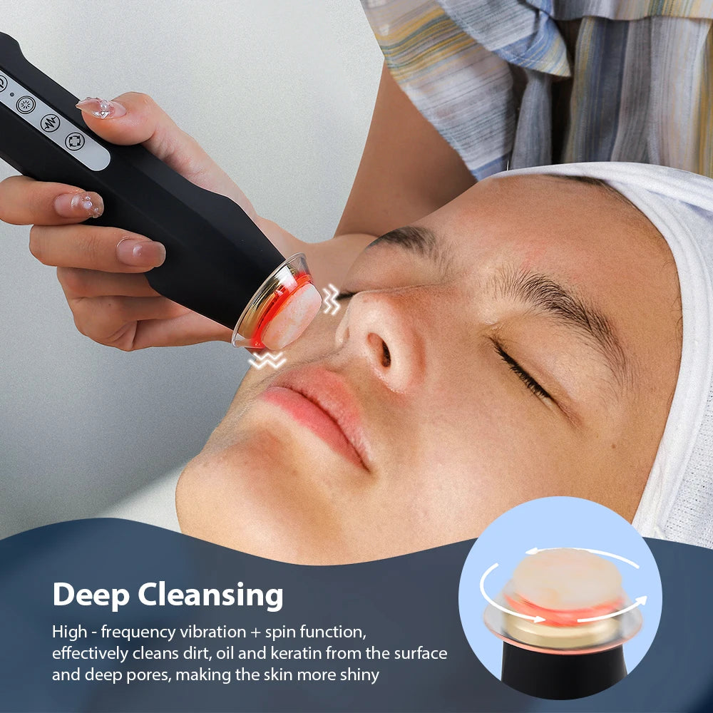 Foreverlily Oxygen Bubble Pen Facial CO2 Machine for Skin Care