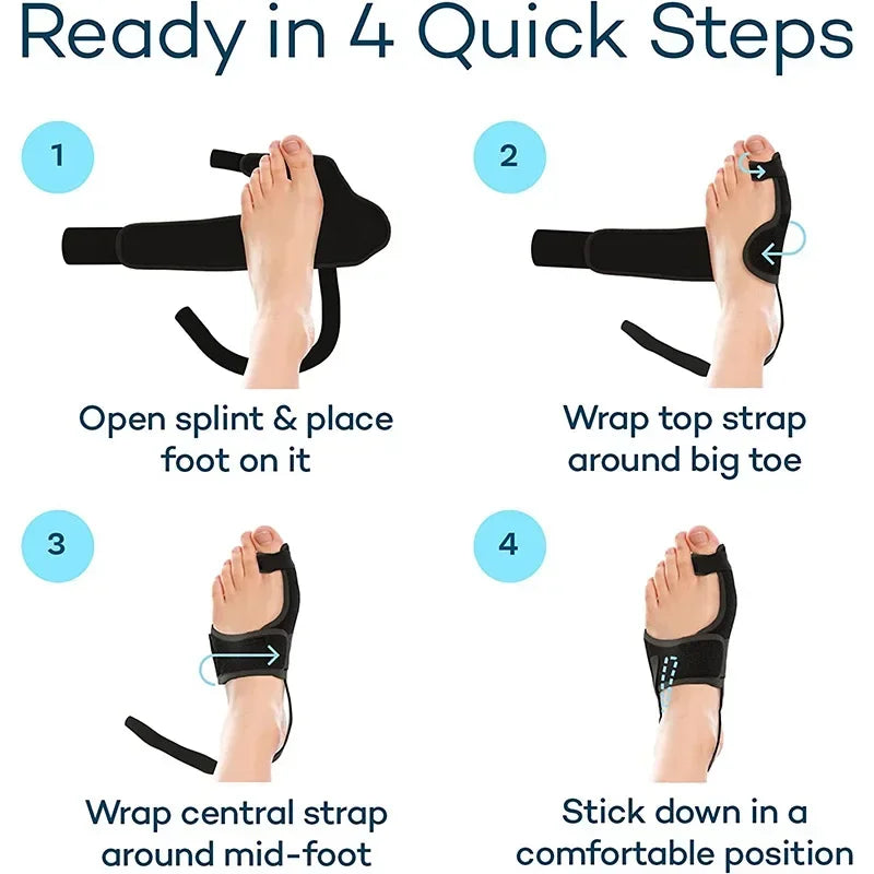 Orthopedic Bunion Splint Corrector for Hallux Valgus Pain Relief