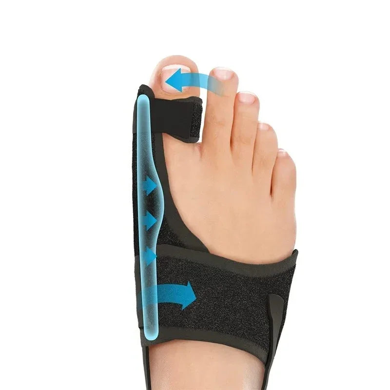 Orthopedic Bunion Splint Corrector for Hallux Valgus Pain Relief