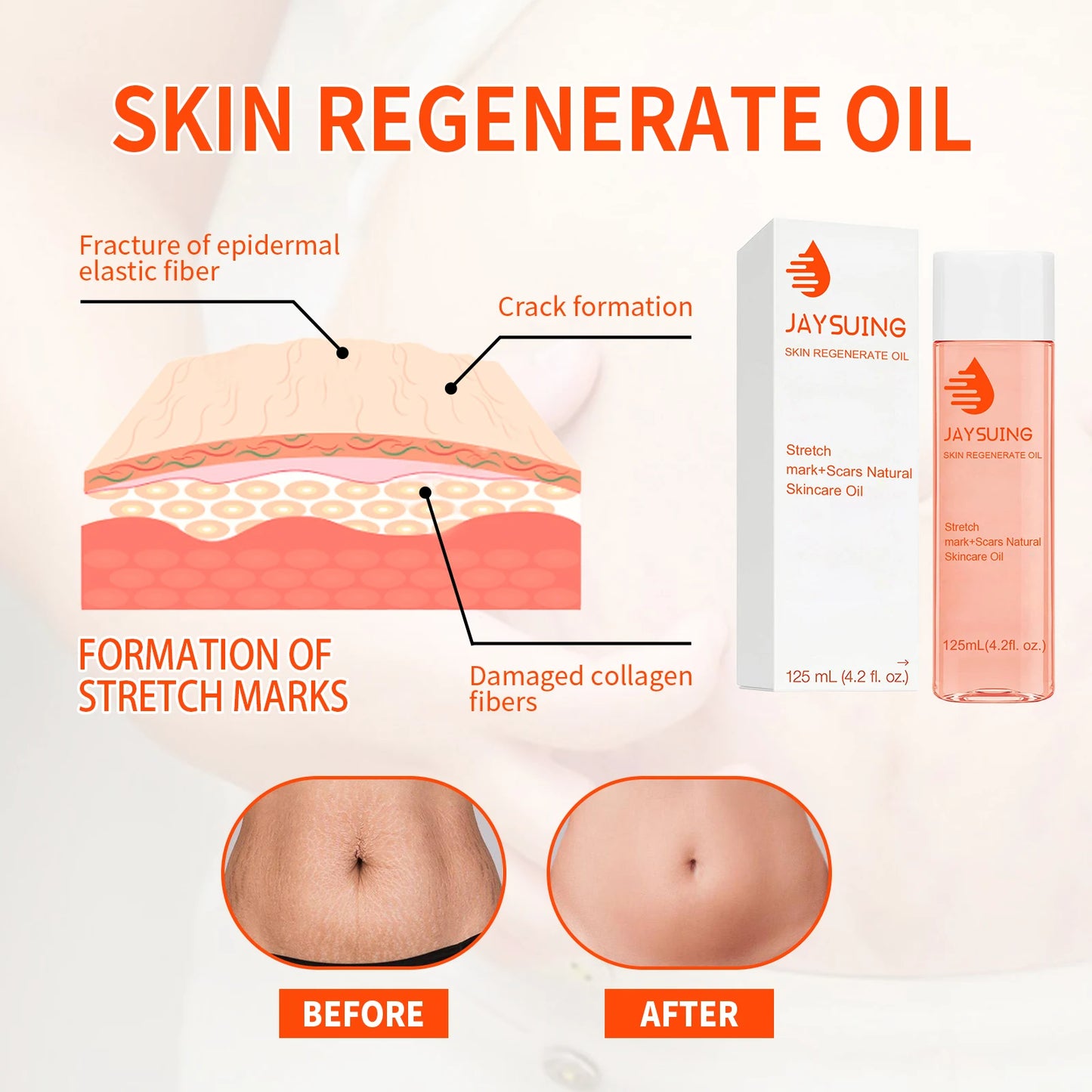 Jaysuing Scar Repair Oil For Moisturizing Elastic Skin