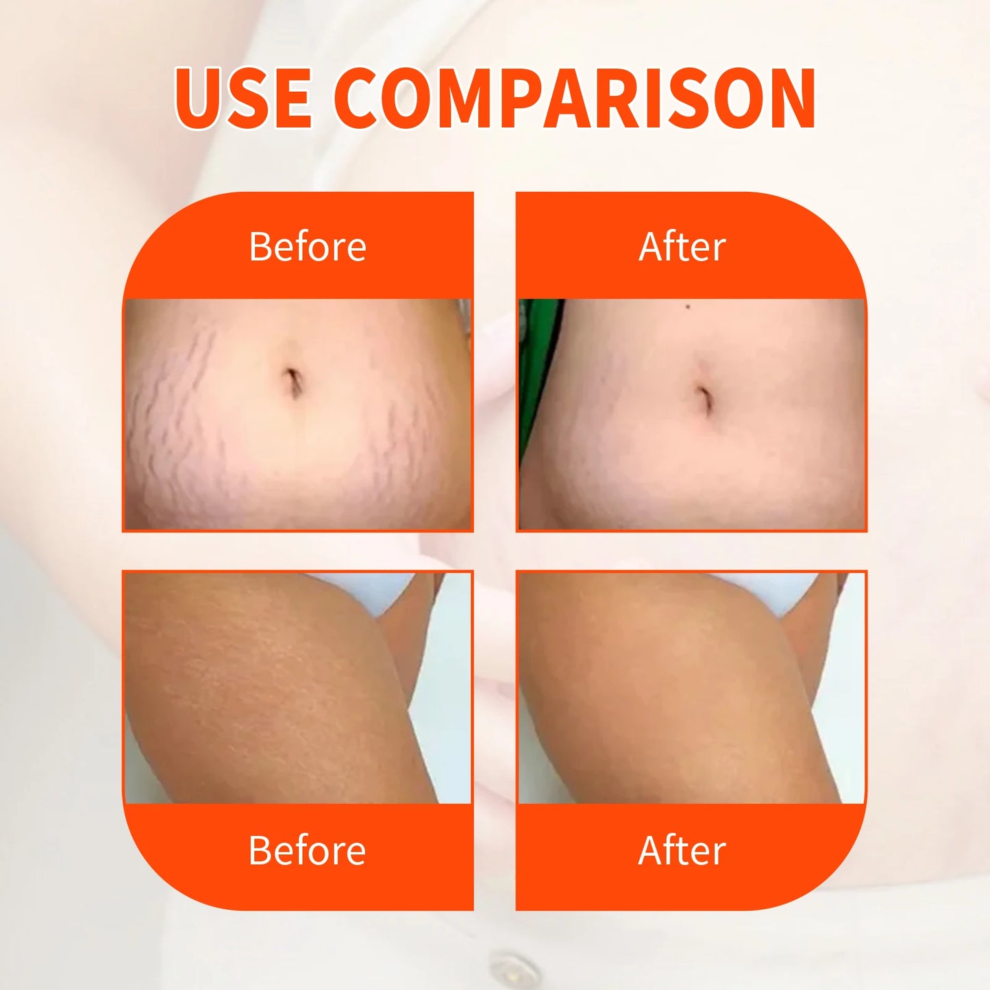 Jaysuing Scar Repair Oil For Moisturizing Elastic Skin